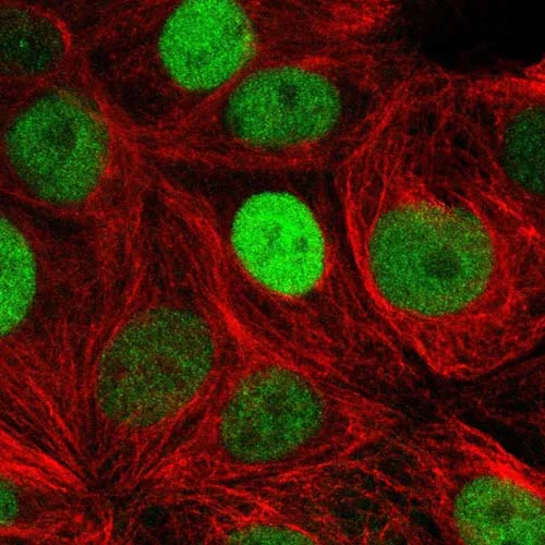 Immunocytochemistry/ Immunofluorescence - Anti-TRPS1 antibody (AB221118)