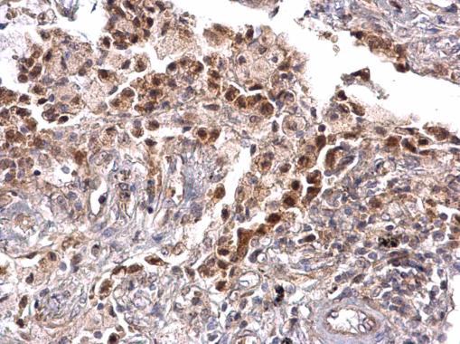 Immunohistochemistry (Formalin/PFA-fixed paraffin-embedded sections) - Anti-TRPS1 antibody (AB227867)