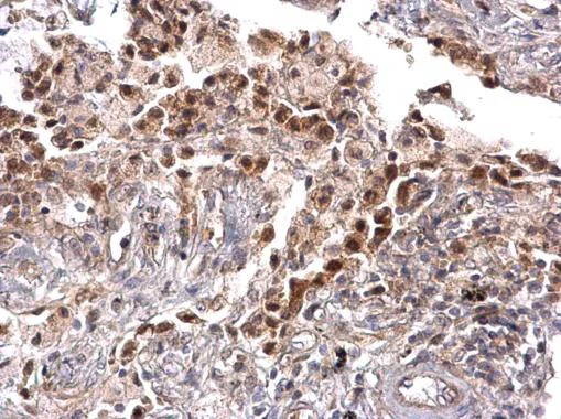 Immunohistochemistry (Formalin/PFA-fixed paraffin-embedded sections) - Anti-TRPS1 antibody (AB227867)