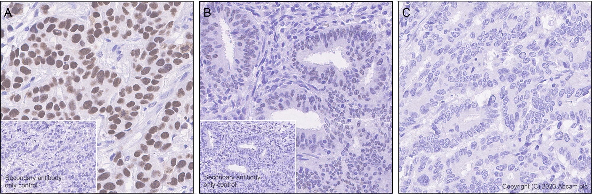 Immunohistochemistry (Formalin/PFA-fixed paraffin-embedded sections) - Anti-TRPS1 antibody [EPR16171] (ab209664), expandable thumbnail
