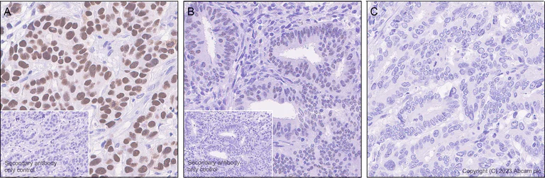 Immunohistochemistry (Formalin/PFA-fixed paraffin-embedded sections) - Anti-TRPS1 antibody [EPR16171] (AB209664)