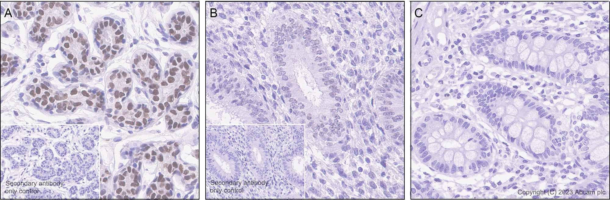 Immunohistochemistry (Formalin/PFA-fixed paraffin-embedded sections) - Anti-TRPS1 antibody [EPR16171] (AB209664), expandable thumbnail