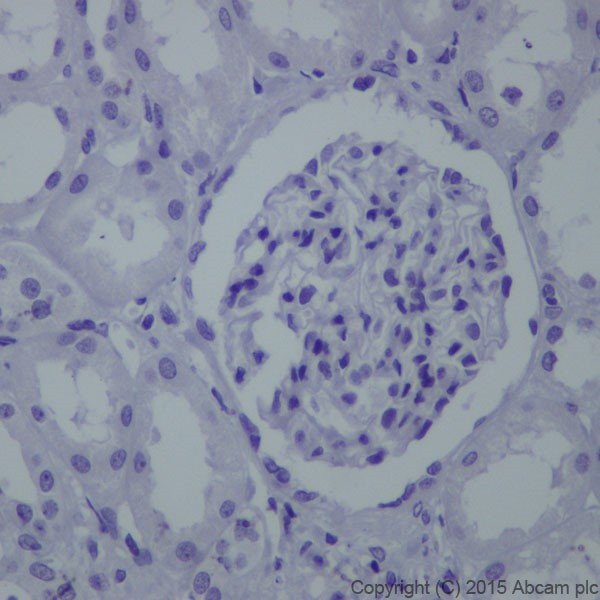 Immunohistochemistry (Formalin/PFA-fixed paraffin-embedded sections) - Anti-TRPS1 antibody [EPR16171] (AB209664), expandable thumbnail