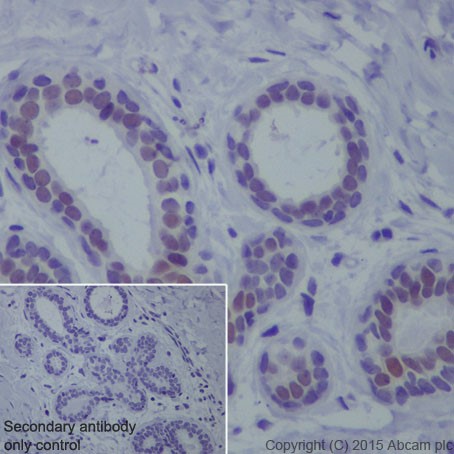Immunohistochemistry (Formalin/PFA-fixed paraffin-embedded sections) - Anti-TRPS1 antibody [EPR16171] (AB209664), expandable thumbnail