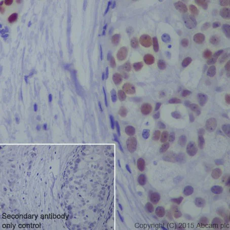 Immunohistochemistry (Formalin/PFA-fixed paraffin-embedded sections) - Anti-TRPS1 antibody [EPR16171] - BSA and Azide free (AB251509)