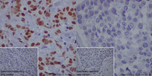 Immunohistochemistry (Formalin/PFA-fixed paraffin-embedded sections) - Anti-TRPS1 antibody [EPR16171] - BSA and Azide free (AB251509)