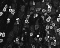 Immunohistochemistry (PFA perfusion fixed frozen sections) - Anti-TRPV1 antibody (AB10296)