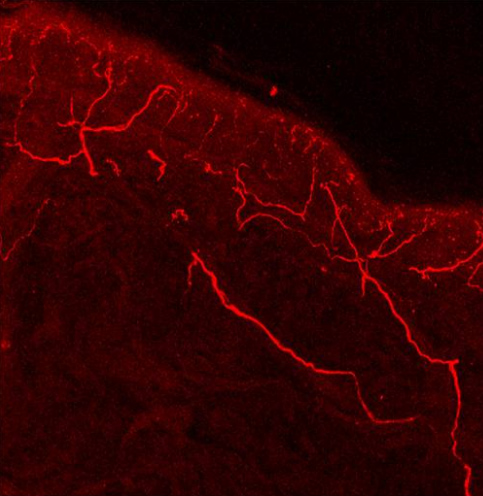 Immunohistochemistry (Frozen sections) - Anti-TRPV1 antibody (AB3487), expandable thumbnail