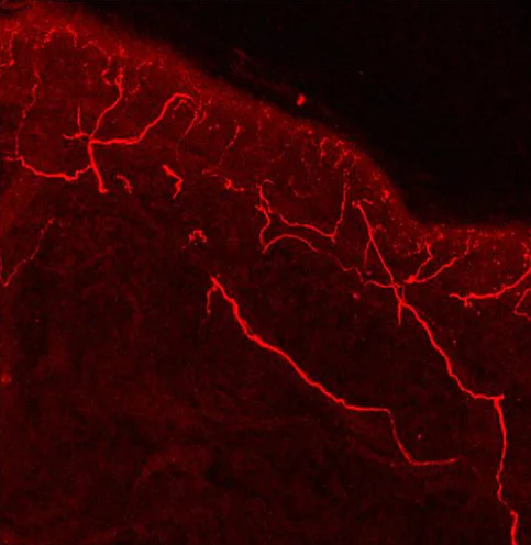 Immunohistochemistry (Frozen sections) - Anti-TRPV1 antibody (AB3487)
