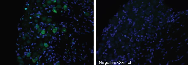 Immunohistochemistry - Free Floating - Anti-TRPV1 antibody (AB6166)