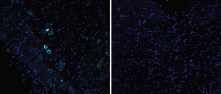 Immunohistochemistry - Free Floating - Anti-TRPV1 antibody (AB6166)