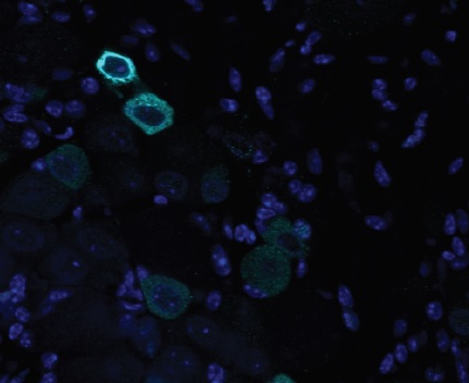 Immunohistochemistry - Free Floating - Anti-TRPV1 antibody (AB6166)