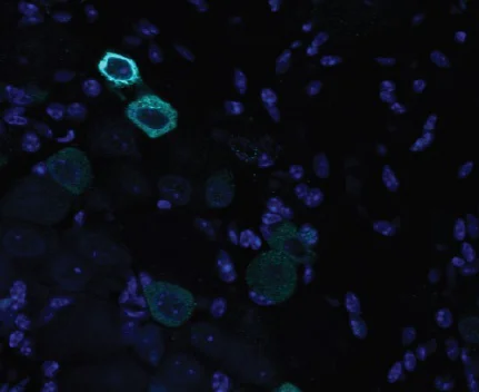 Immunohistochemistry - Free Floating - Anti-TRPV1 antibody (AB6166)