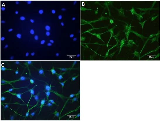 Immunocytochemistry/ Immunofluorescence - Anti-TRPV1 antibody [BS397] - C-terminal (AB203103)