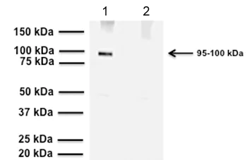 Western blot - Anti-TRPV1 antibody [BS397] - C-terminal (AB203103)