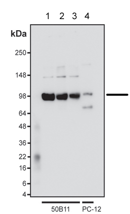 Western blot - Anti-TRPV1 antibody [BS397] - C-terminal (AB203103)