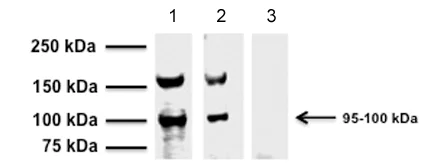Western blot - Anti-TRPV1 antibody [BS397] - C-terminal (AB203103)