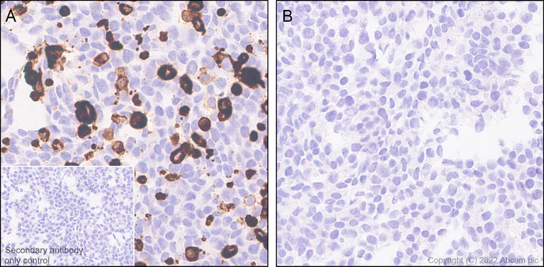 Immunohistochemistry (Formalin/PFA-fixed paraffin-embedded sections) - Anti-TRPV1 antibody [EPR25057-67] (AB305299)