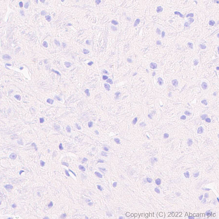 Immunohistochemistry (Formalin/PFA-fixed paraffin-embedded sections) - Anti-TRPV1 antibody [EPR25057-67] (ab305299), expandable thumbnail