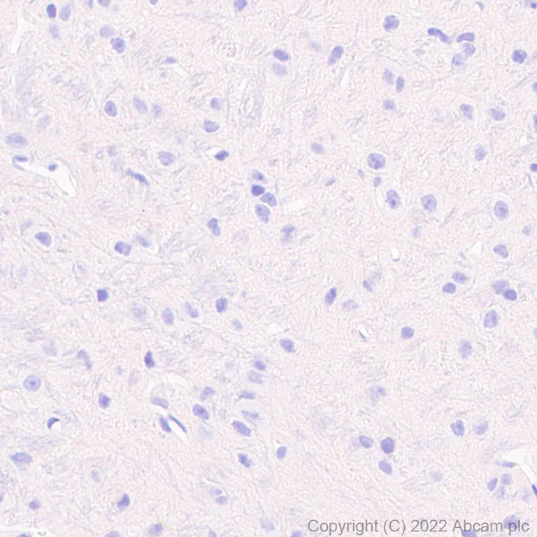 Immunohistochemistry (Formalin/PFA-fixed paraffin-embedded sections) - Anti-TRPV1 antibody [EPR25057-67] (AB305299)