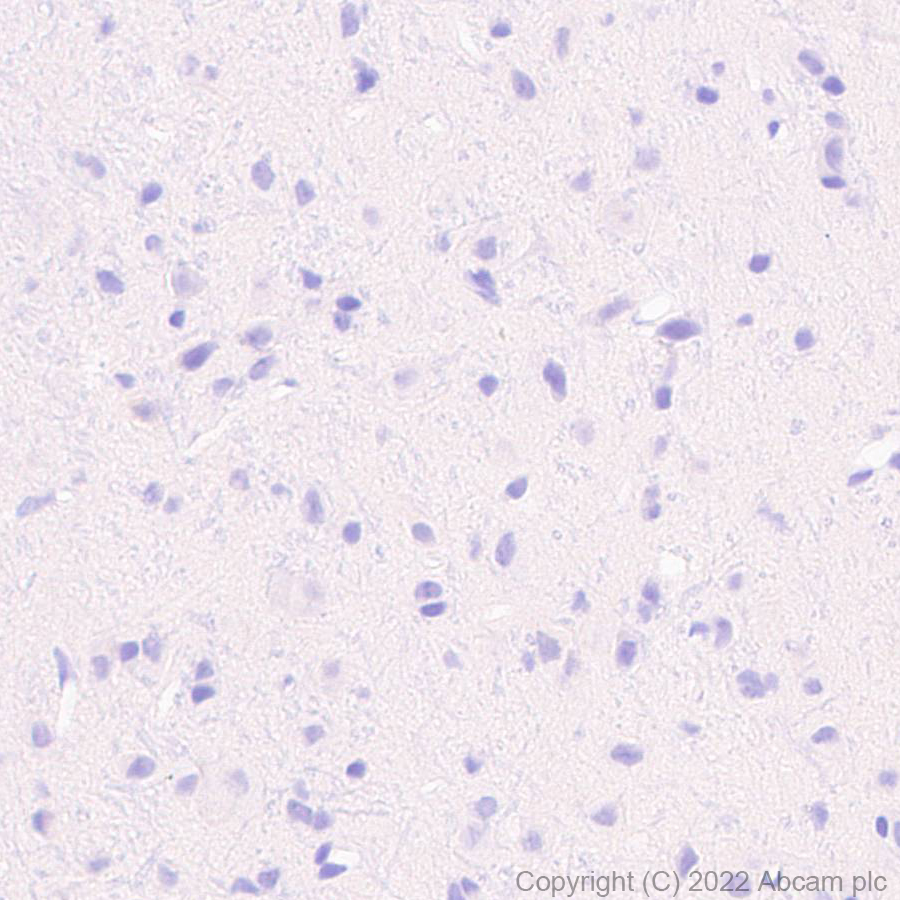 Immunohistochemistry (Formalin/PFA-fixed paraffin-embedded sections) - Anti-TRPV1 antibody [EPR25057-67] (AB305299), expandable thumbnail