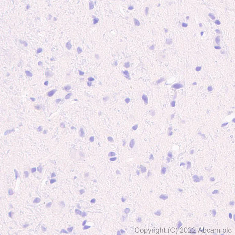Immunohistochemistry (Formalin/PFA-fixed paraffin-embedded sections) - Anti-TRPV1 antibody [EPR25057-67] (AB305299)