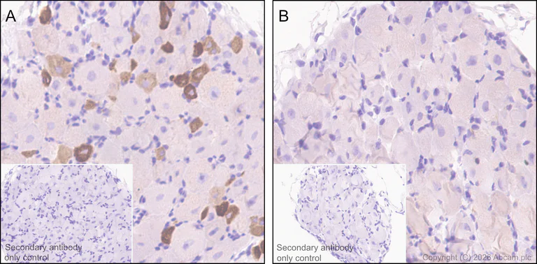 Immunohistochemistry (Formalin/PFA-fixed paraffin-embedded sections) - Anti-TRPV1 antibody [EPR25057-67] (AB305299)