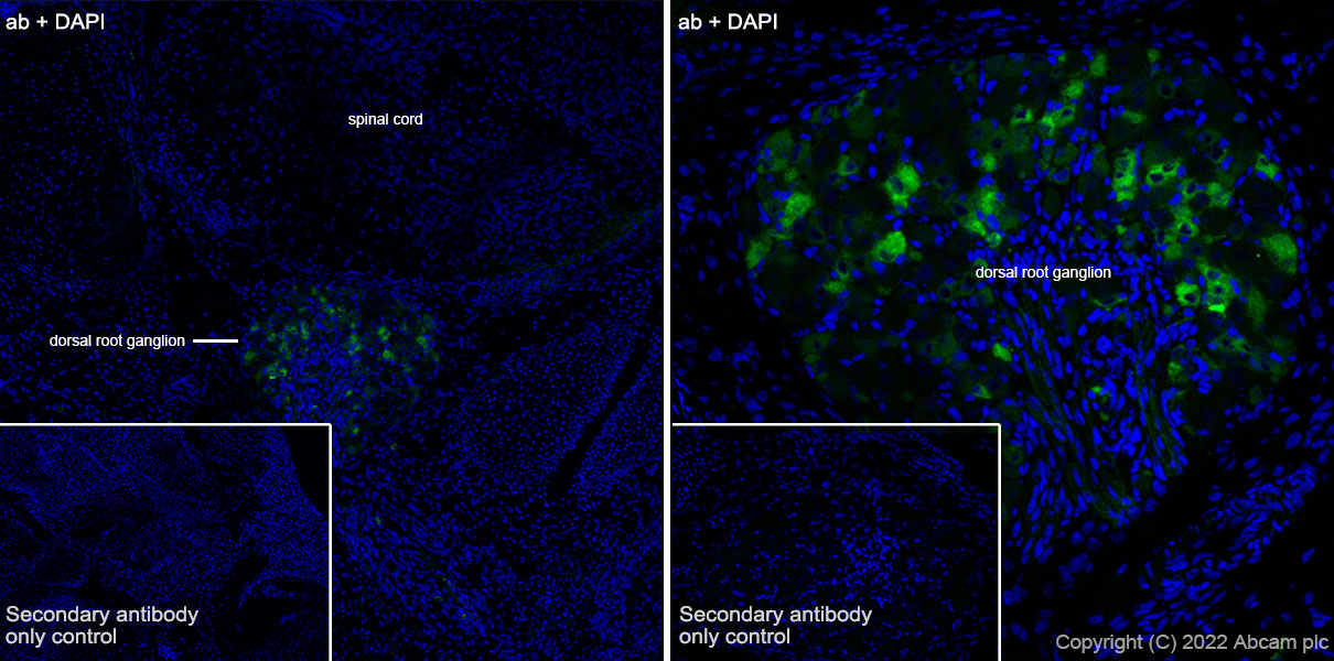 Immunohistochemistry (Frozen sections) - Anti-TRPV1 antibody [EPR25057-67] (AB305299), expandable thumbnail