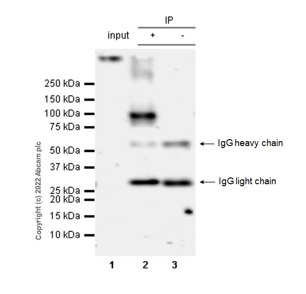 Immunoprecipitation - Anti-TRPV1 antibody [EPR25057-67] (AB305299), expandable thumbnail