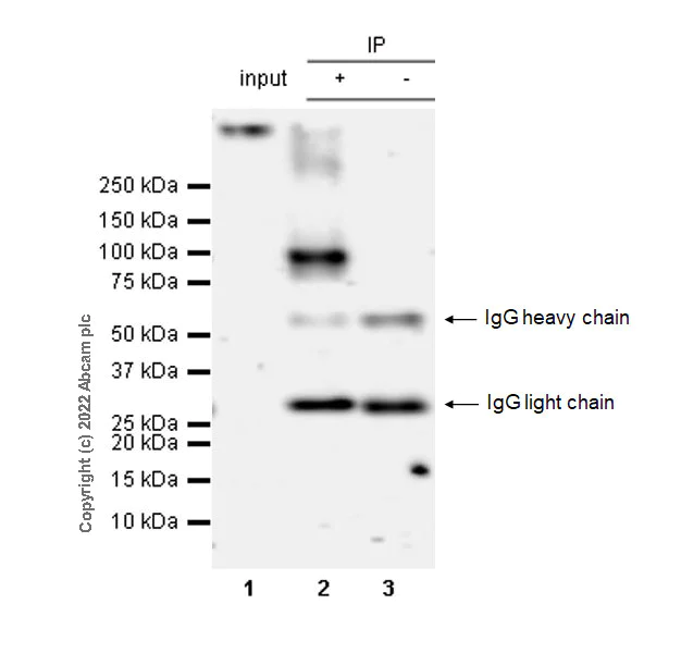 Immunoprecipitation - Anti-TRPV1 antibody [EPR25057-67] (AB305299)