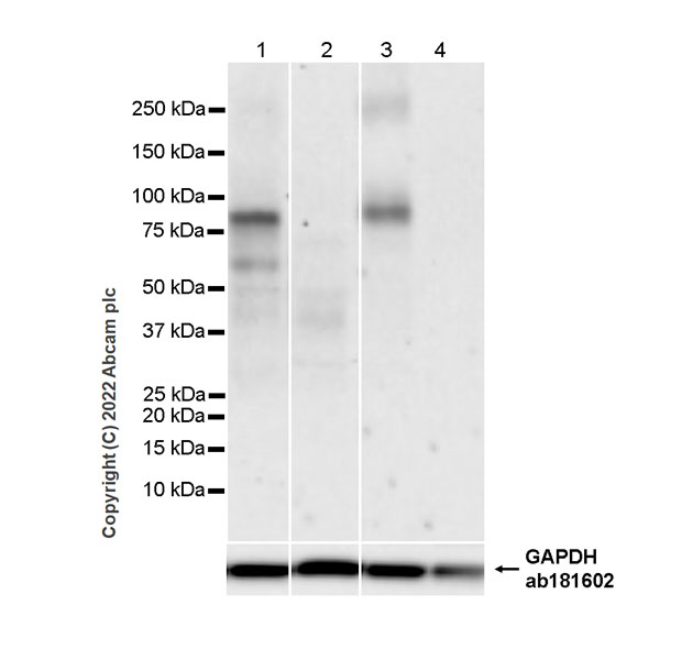 Western blot - Anti-TRPV1 antibody [EPR25057-67] (ab305299), expandable thumbnail