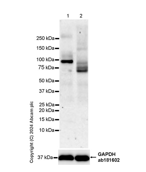 Western blot - Anti-TRPV1 antibody [EPR25057-67] (AB305299), expandable thumbnail