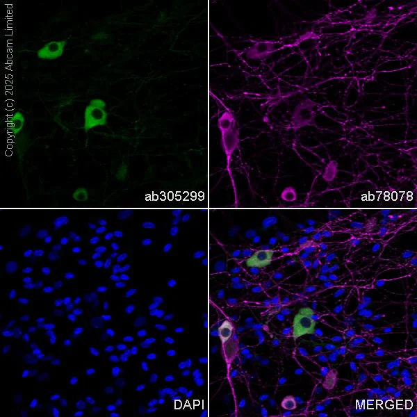 Immunocytochemistry/ Immunofluorescence - Anti-TRPV1 antibody [EPR25057-67] - BSA and Azide free (AB305300)