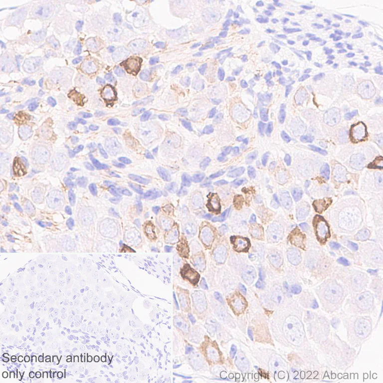 Immunohistochemistry (Formalin/PFA-fixed paraffin-embedded sections) - Anti-TRPV1 antibody [EPR25057-67] - BSA and Azide free (AB305300)