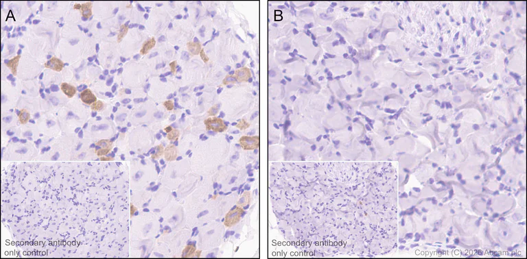 Immunohistochemistry (Formalin/PFA-fixed paraffin-embedded sections) - Anti-TRPV1 antibody [N221/17] (AB305178)