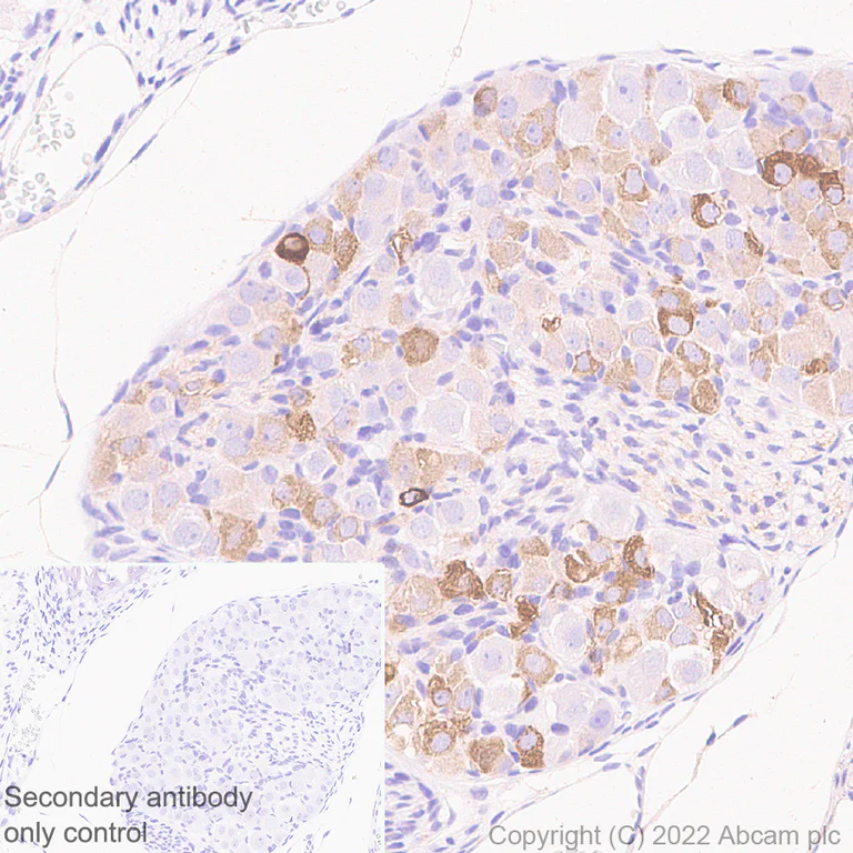 Immunohistochemistry (Formalin/PFA-fixed paraffin-embedded sections) - Anti-TRPV1 antibody [N221/17] - BSA and Azide free (AB305179)