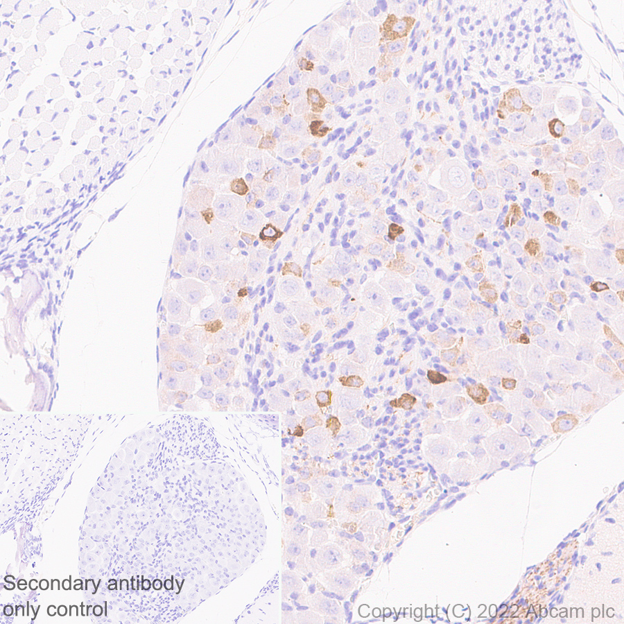 Immunohistochemistry (Formalin/PFA-fixed paraffin-embedded sections) - Anti-TRPV1 antibody [N221/17] - BSA and Azide free (AB305179), expandable thumbnail