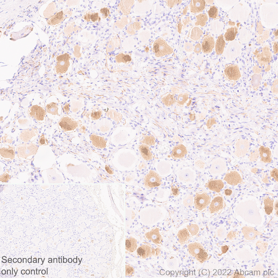 Immunohistochemistry (Formalin/PFA-fixed paraffin-embedded sections) - Anti-TRPV1 antibody [N221/17] - BSA and Azide free (AB305179), expandable thumbnail