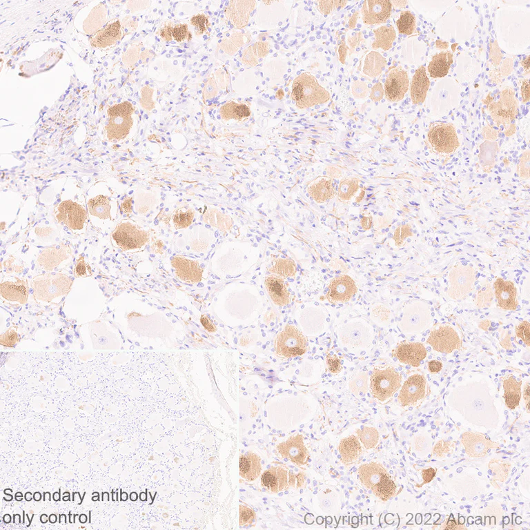 Immunohistochemistry (Formalin/PFA-fixed paraffin-embedded sections) - Anti-TRPV1 antibody [N221/17] - BSA and Azide free (AB305179)