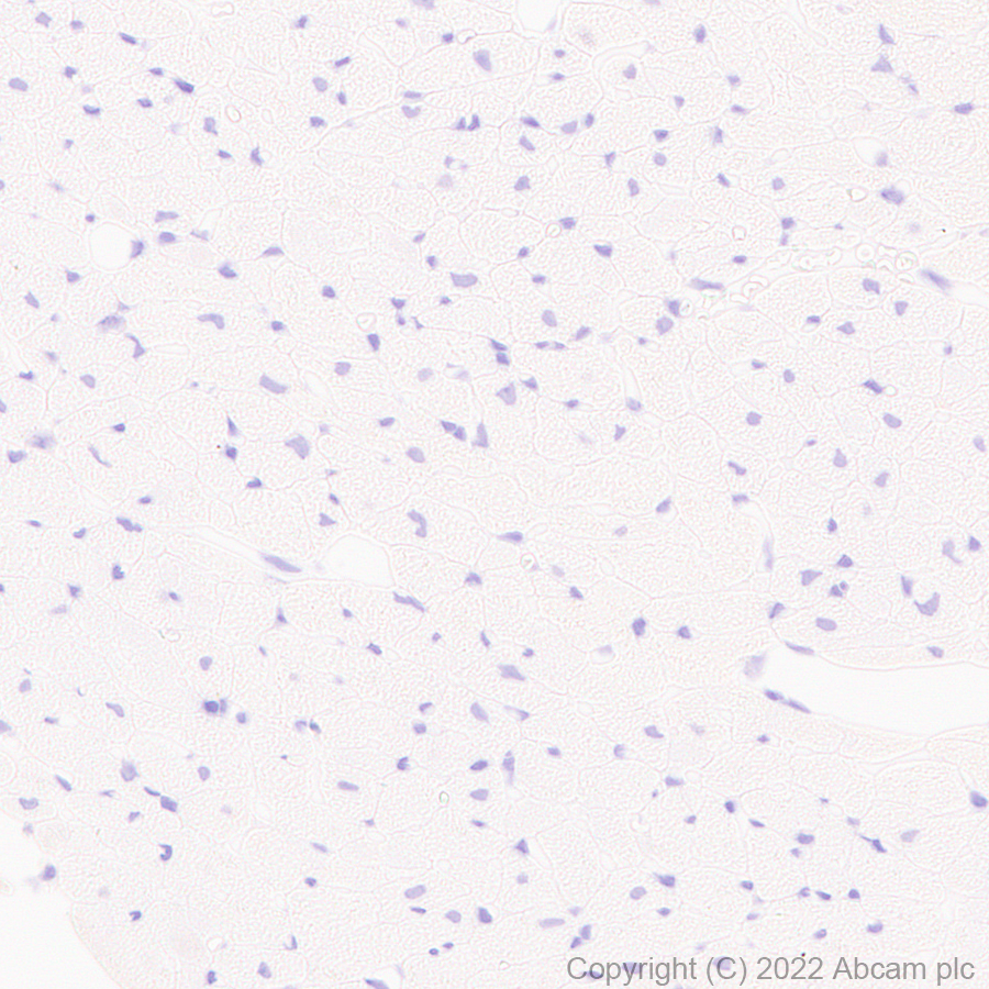 Immunohistochemistry (Formalin/PFA-fixed paraffin-embedded sections) - Anti-TRPV1 antibody [N221/17] - BSA and Azide free (AB305179), expandable thumbnail