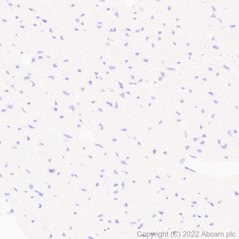 Immunohistochemistry (Formalin/PFA-fixed paraffin-embedded sections) - Anti-TRPV1 antibody [N221/17] - BSA and Azide free (AB305179)