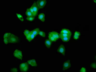 Immunocytochemistry/ Immunofluorescence - Anti-TRPV2 antibody (AB236955)