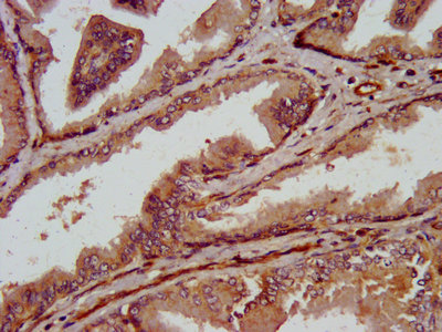 Immunohistochemistry (Formalin/PFA-fixed paraffin-embedded sections) - Anti-TRPV2 antibody (AB236955), expandable thumbnail
