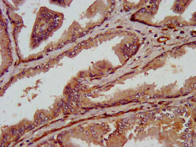 Immunohistochemistry (Formalin/PFA-fixed paraffin-embedded sections) - Anti-TRPV2 antibody (AB236955)