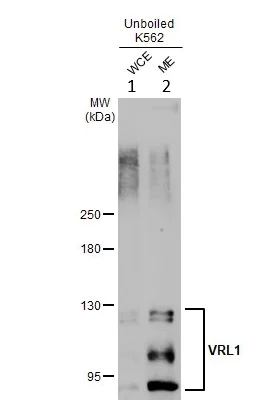 Western blot - Anti-TRPV2 antibody (AB272862)