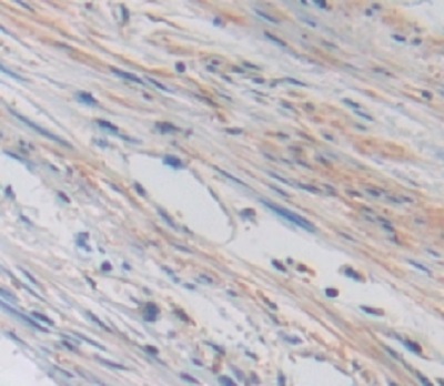 Immunohistochemistry (Formalin/PFA-fixed paraffin-embedded sections) - Anti-TRPV3 antibody (AB231150)