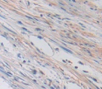 Immunohistochemistry (Formalin/PFA-fixed paraffin-embedded sections) - Anti-TRPV3 antibody (AB231150)