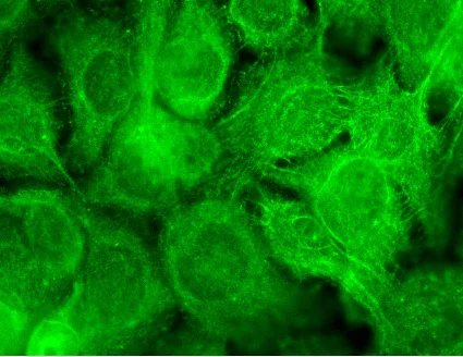 Immunocytochemistry/ Immunofluorescence - Anti-TRPV3 antibody [N15/39] (AB94582)