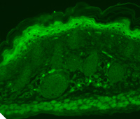Immunohistochemistry (Formalin/PFA-fixed paraffin-embedded sections) - Anti-TRPV3 antibody [N15/4] (AB85022), expandable thumbnail