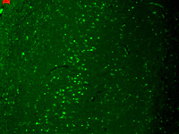 Immunohistochemistry (Formalin/PFA-fixed paraffin-embedded sections) - Anti-TRPV3 antibody [N15/4] (AB85022), expandable thumbnail